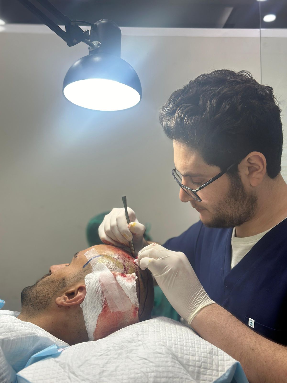 Hair Transplant Clinic Peshawar